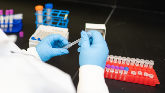 Close-up of a researcher handling blood samples in a laboratory setting for Alzheimer's testing.